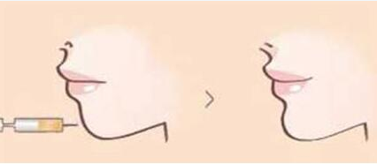 /Public/ueditor/php/upload/image/20190430/1556607264961894.png