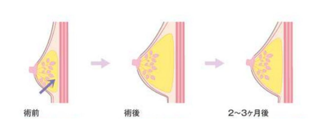 /Public/ueditor/php/upload/image/20190507/1557220322524573.png