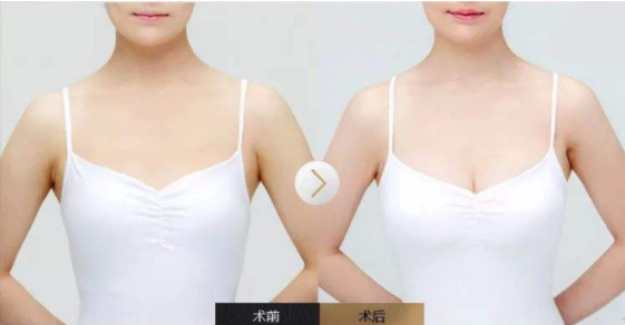 /Public/ueditor/php/upload/image/20190507/1557220342892684.png