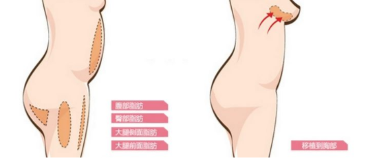 /Public/ueditor/php/upload/image/20190509/1557393737223767.png