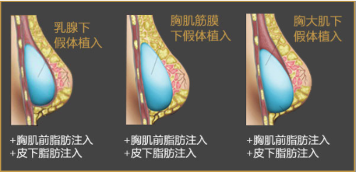 /Public/ueditor/php/upload/image/20190509/1557394361173615.png