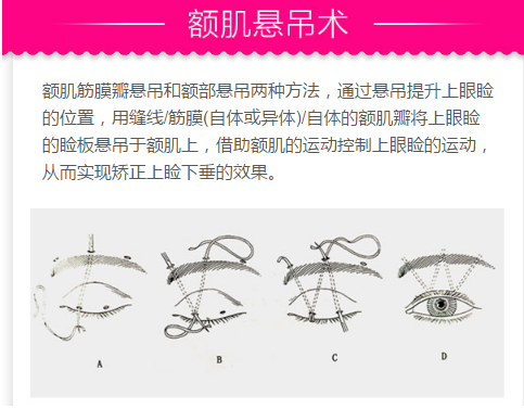 /Public/ueditor/php/upload/image/20190513/1557735856284501.png