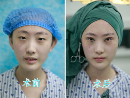 /Public/ueditor/php/upload/image/20190513/1557736047728213.png