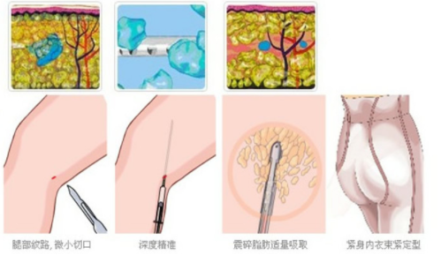 /Public/ueditor/php/upload/image/20190515/1557906466339253.png