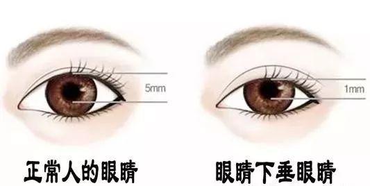 /Public/ueditor/php/upload/image/20190515/1557906795411286.jpg