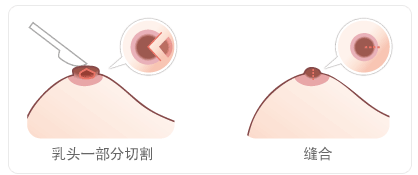 /Public/ueditor/php/upload/image/20190515/1557907053940194.png