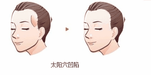/Public/ueditor/php/upload/image/20190516/1557986082195176.jpg