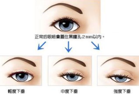 /Public/ueditor/php/upload/image/20190516/1557992759290556.jpg