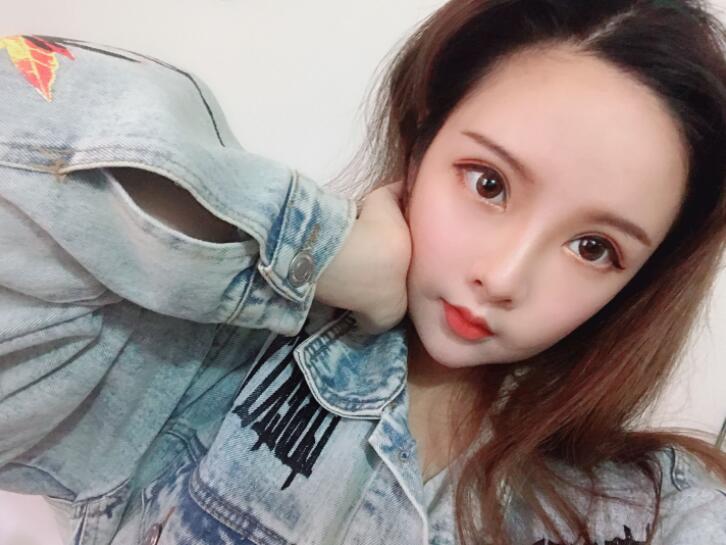 内双可以割双眼皮吗