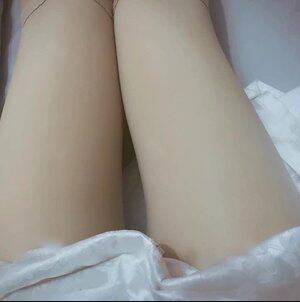 腿部吸脂手术价格是多少