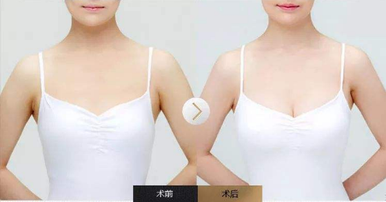 /Public/ueditor/php/upload/image/20190604/1559620413468745.png