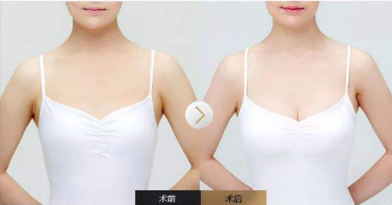 /Public/ueditor/php/upload/image/20190611/1560223081772064.png