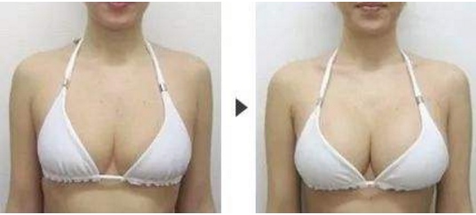 /Public/ueditor/php/upload/image/20190622/1561173661694987.png