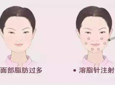 /Public/ueditor/php/upload/image/20190905/1567667879251999.png