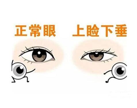 /Public/ueditor/php/upload/image/20201120/1605860944241940.jpg