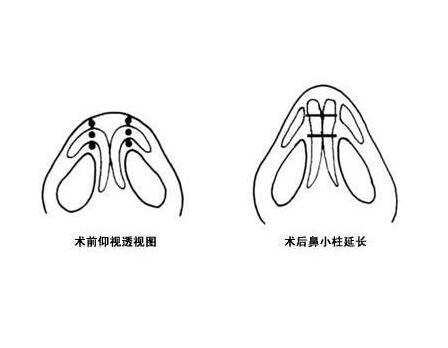 /Public/ueditor/php/upload/image/20201207/1607329328936193.jpg