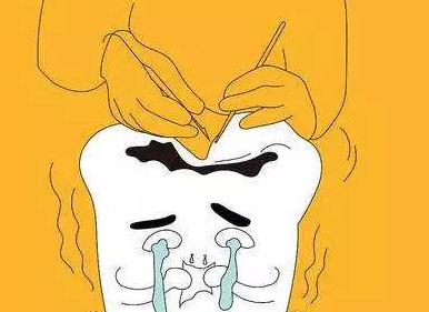 补牙后一般要疼几天
