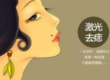 激光点痣多久能恢复
