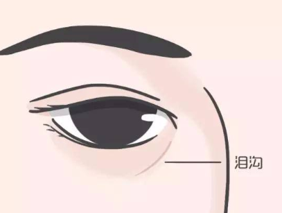 泪沟是怎么形成的