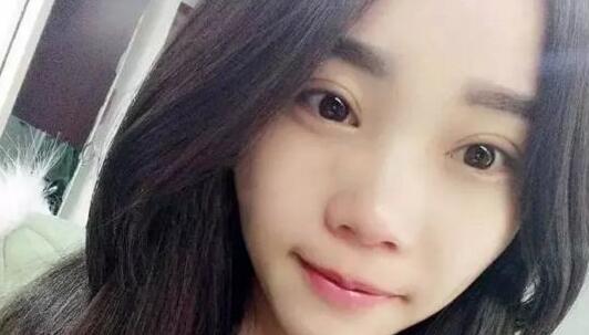 单眼皮如何变成双眼皮?