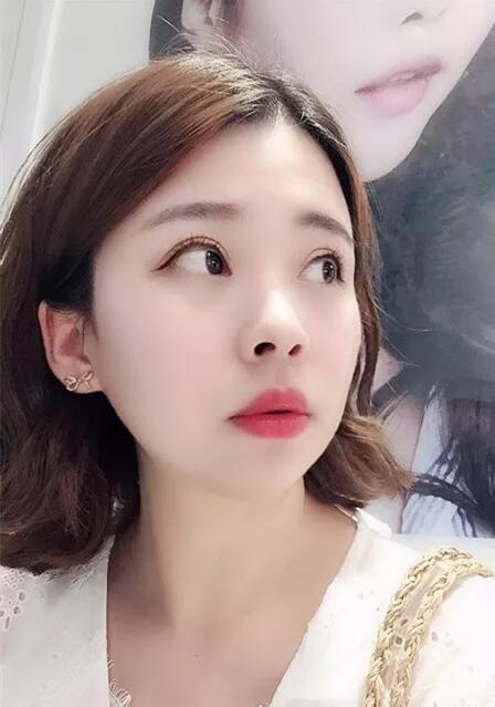 【分享】这样的整形方式可能会让你毁容