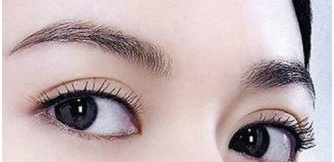 北京双眼皮修复哪家医院好？北京美莱双眼皮修复多少钱？