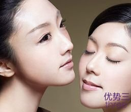 广州韩佳人做假体垫下巴多少钱？假体垫下巴后效果有哪些？