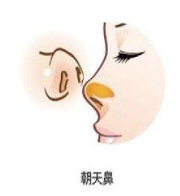 隆鼻修复手术价格是多少呢？