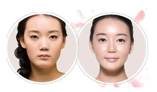 广州韩妃改脸型需要多少钱？