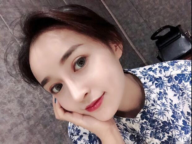 四川华人整形美容医院假体隆鼻术后注意事项，术前术后案例分享