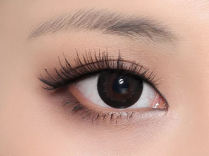 杭州格莱美开眼角需要多长时间恢复？