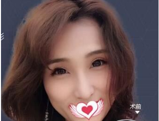 广州美莱和禾丽哪家好?广州美莱和禾丽整形医院价格表？