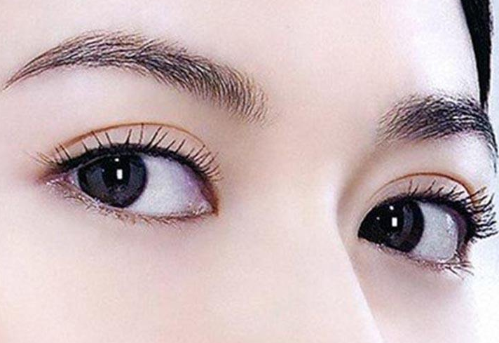 在重庆西南整形美容外科医院割双眼皮手术是否安全？