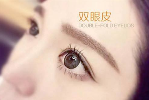 广州秀妍医疗美容医院韩式双眼皮大概要多少钱呢?