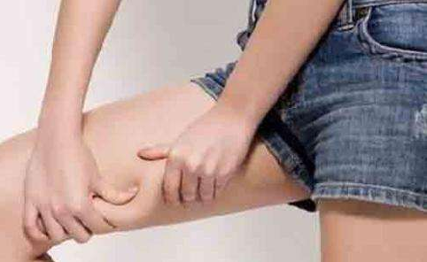 广州秀妍医疗美容医院大腿抽脂术后应注意什么?