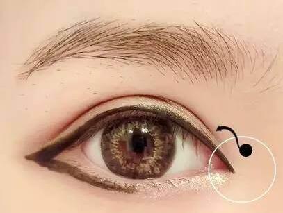 如何判断自己是否需要开眼角