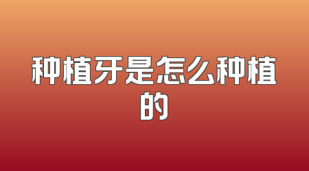 种植牙是怎么种植的