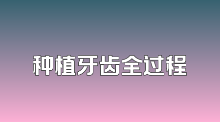 种植牙齿全过程