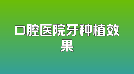 口腔医院牙种植效果