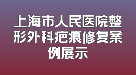 上海市人民医院整形外科疤痕修复案例展示