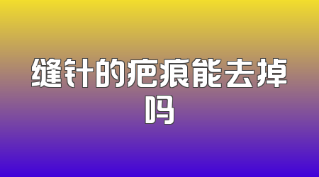缝针的疤痕能去掉吗
