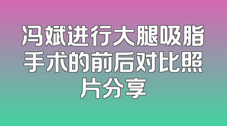 冯斌进行大腿吸脂手术的前后对比照片分享