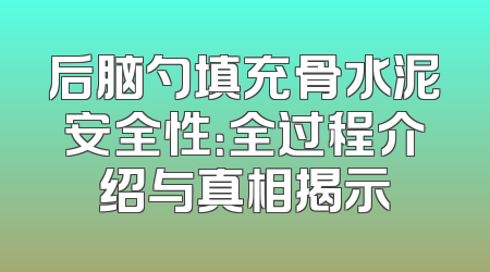 后脑勺填充骨水泥安全性：全过程介绍与真相揭示