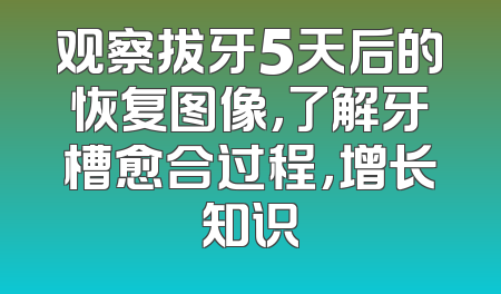 观察拔牙5天后的恢复图像，了解牙槽愈合过程，增长知识