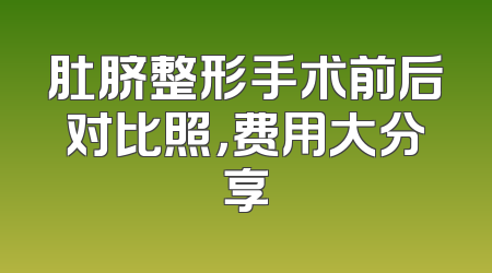 肚脐整形手术前后对比照，费用大分享