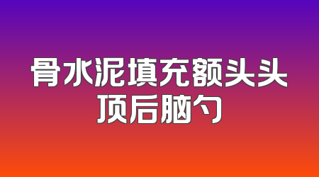 骨水泥填充额头头顶后脑勺