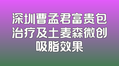 深圳曹孟君富贵包治疗及土麦森微创吸脂效果