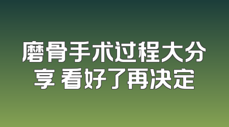 磨骨手术过程大分享 看好了再决定