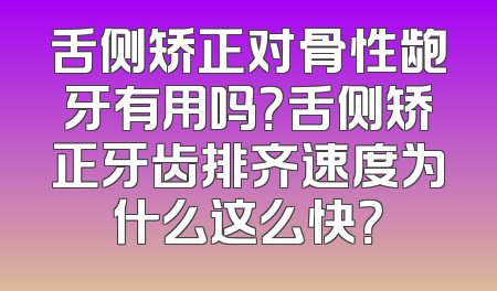 舌侧矫正对骨性龅牙有用吗？舌侧矫正牙齿排齐速度为什么这么快？