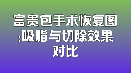 富贵包手术恢复图：吸脂与切除效果对比
